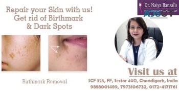 Dr Naiya Bansal - Best Skin Specialist 